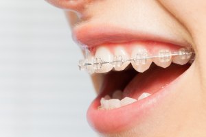 蛀牙痛怎麼快速止痛？口腔科醫生教你幾招
