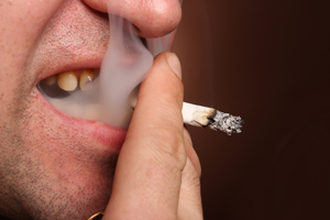 美白牙齒多少錢？深圳博愛曙光醫院口腔科爲您解答